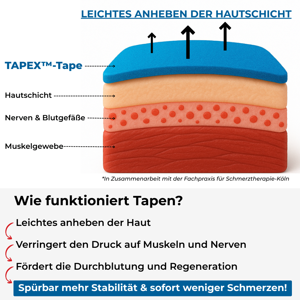 TAPEX™ - Schultergelenk